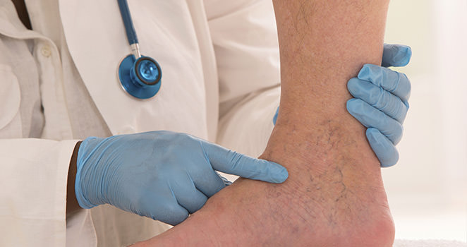 methods-treatment-veins methods-treatment-veins